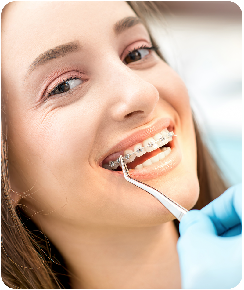 Cost Of Braces How Much Braces Really Cost Fusion Orthodontics